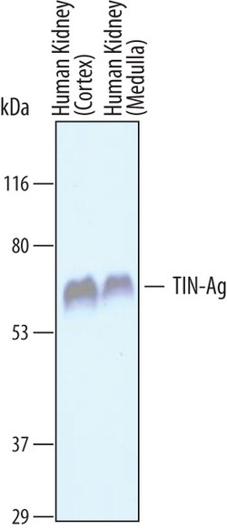 Human TIN-Ag Antibody, R D Systems 25&mu;g; Unlabeled:Anticuerpos
