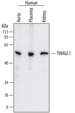 Human TINAGL1 Antibody, R D Systems 100&mu;g; Unlabeled:Antibodies, Polyclonal