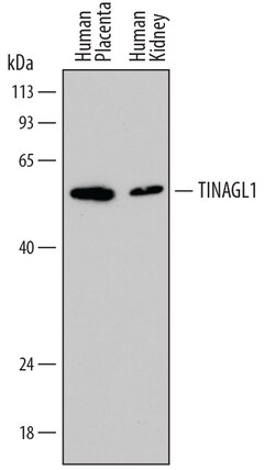 Human TINAGL1 Antibody, R D Systems 25 &mu;g | Buy Online | R&D Systems | Fisher Scientific