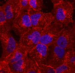 Human TM4SF1/L6 Antibody, R D Systems 100ug; Unlabeled:Antibodies, Monoclonal