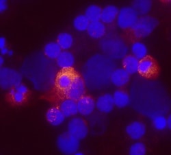 Human Lymphotoxin-alpha/TNF-beta Antibody, R D Systems 500ug; Unlabeled:Antibodies,