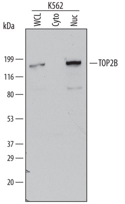Human TOP2B Antibody, R D Systems 100&mu;g; Unlabeled:Antibodies, Polyclonal