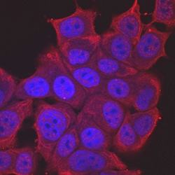 Human/Mouse TOR Antibody, R D Systems 25&mu;g; Unlabeled:Antibodies, Monoclonal