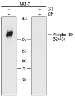 Human Phospho-TOR (S2448) Antibody, R D Systems 25&mu;g; Unlabeled:Antibodies,