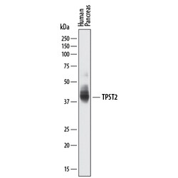 Human Tyrosylprotein Sulfotransferase 2/TPST2 Antibody, R D Systems 100 &mu;g | Buy Online | R&D Systems | Fisher Scientific