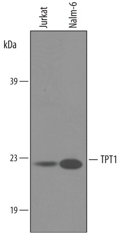 Human TPT1/TCTP Antibody, R D Systems 100&mu;g; Unlabeled:Antibodies, Polyclonal