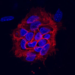Human TRA-1-85/CD147 Antibody, R D Systems 100ug; Unlabeled:Antibodies,