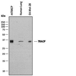Human TRACP/PAP/ACP5 Antibody, R D Systems 100 &mu;g | Buy Online | R&D Systems | Fisher Scientific