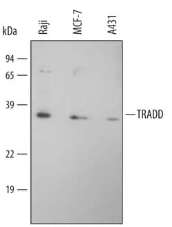 Human TRADD Antibody, R D Systems 25 &mu;g | Buy Online | R&D Systems | Fisher Scientific