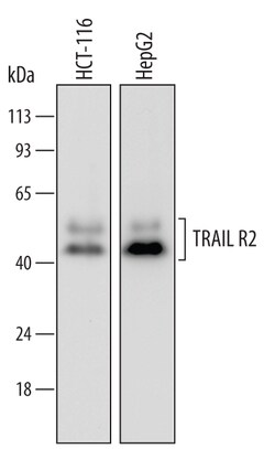 Human TRAIL R2/TNFRSF10B Antibody, R D Systems 100ug; Unlabeled:Antibodies,