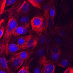 Mouse TRAM/TICAM2 Antibody, R D Systems 25&mu;g; Unlabeled:Antibodies,