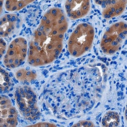 Human Transcobalamin II Antibody, R D Systems 25&mu;g; Unlabeled:Antibodies,