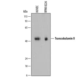 Human Transcobalamin II Antibody, R D Systems 25&mu;g; Unlabeled:Antibodies,