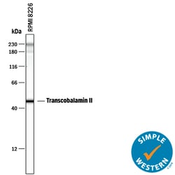 Human Transcobalamin II Antibody, R D Systems 100ug; Unlabeled:Antibodies,