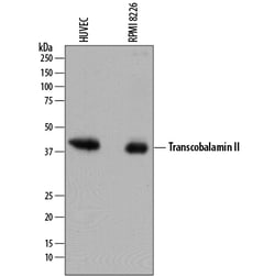 Human Transcobalamin II Antibody, R D Systems 100ug; Unlabeled:Antibodies,