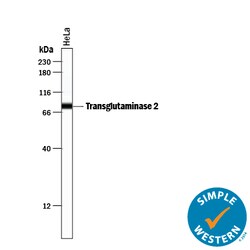 Human/Mouse/Rat Transglutaminase 2/TGM2 Antibody, R D Systems 25&mu;g;