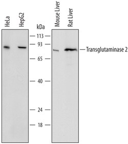 Human/Mouse/Rat Transglutaminase 2/TGM2 Antibody, R D Systems 25&mu;g;