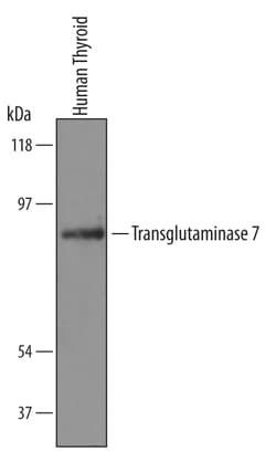 Human Transglutaminase 7/TGM7 Antibody, R D Systems 25&mu;g; Unlabeled:Antibodies,