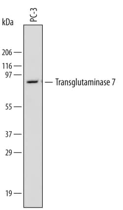 Human Transglutaminase 7/TGM7 Antibody, R D Systems 25&mu;g; Unlabeled:Antibodies,