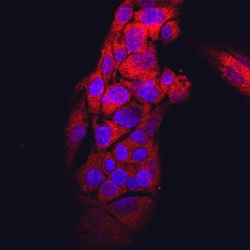 Human Transthyretin/Prealbumin Antibody, R D Systems 25&mu;g; Unlabeled:Antibodies,