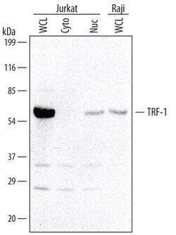 Human TRF-1 Antibody, R D Systems 25&mu;g; Unlabeled:Antibodies, Polyclonal