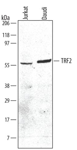 Human TRF2 Antibody, R D Systems 25&mu;g; Unlabeled:Antibodies, Polyclonal
