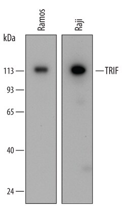 Human TRIF/TICAM1 Antibody, R D Systems 100ug; Unlabeled:Antibodies, Monoclonal