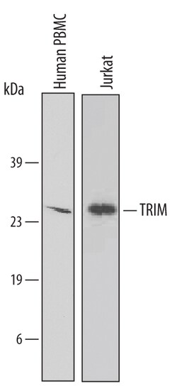 Human TRIM Antibody, R D Systems 100&mu;g; Unlabeled:Antibodies, Polyclonal