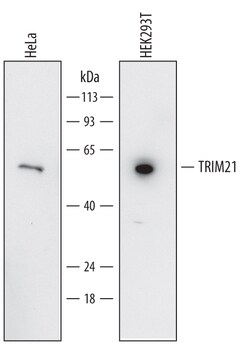 Human TRIM21 Antibody, R D Systems 100ug; Unlabeled:Antibodies, Monoclonal
