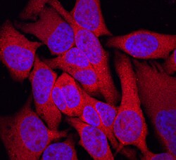 Human/Mouse TRIM32 Antibody, R D Systems 25&mu;g; Unlabeled:Antibodies,