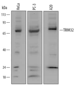 Human/Mouse TRIM32 Antibody, R D Systems 25&mu;g; Unlabeled:Antibodies,