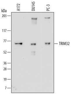 Human TRIM32 Antibody, R D Systems 100ug; Unlabeled:Antibodies, Monoclonal