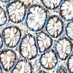 Human TrkA Antibody, R D Systems 100&mu;g; Unlabeled:Antibodies, Polyclonal