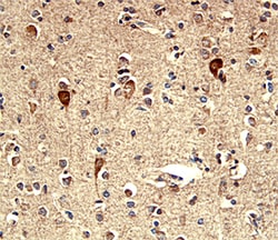 Human TROP-2 Antibody, R D Systems 100&mu;g; Unlabeled:Antibodies, Polyclonal