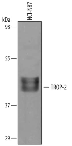 Human TROP-2 Antibody, R D Systems 100&mu;g; Unlabeled:Antibodies, Polyclonal