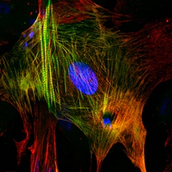Human Troponin I/TNNI3 Antibody, R D Systems 100 ug; Unconjugated:Antibodies,
