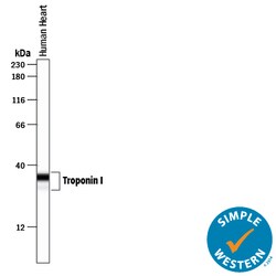 Human Troponin I/TNNI3 Antibody, R D Systems 100 ug; Unconjugated:Antibodies,