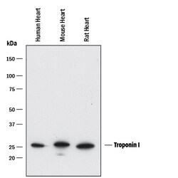 Human Troponin I/TNNI3 Antibody, R D Systems 100 ug; Unconjugated:Antibodies,