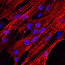 Human Troponin T (Cardiac) Antibody, R D Systems 25&mu;g; Unlabeled:Antibodies,