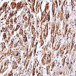 Human Troponin T (Cardiac) Antibody, R D Systems 25&mu;g; Unlabeled:Antibodies,