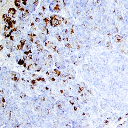 Human Trypsin Pan Specific (PRSS1/2/3) Antibody, R D Systems 100&mu;g;