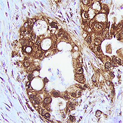 Human Trypsin Pan Specific (PRSS1/2/3) Antibody, R D Systems 100&mu;g;