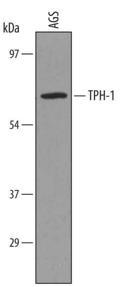 Human Tryptophan Hydroxylase 1/TPH-1 Antibody, R D Systems 100&mu;g; Unlabeled:Antibodies,