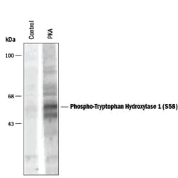 Phospho-Tryptophan Hydroxylase 1/TPH-1 (S58) Antibody, R D Systems 100 &mu;L | Buy Online | R&D Systems | Fisher Scientific