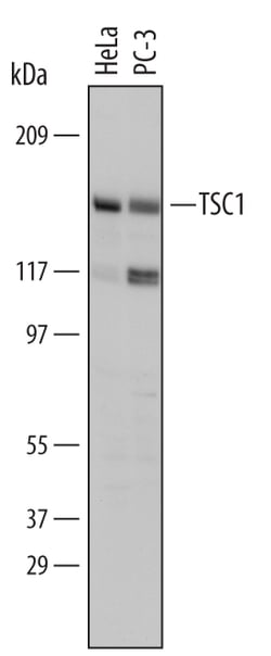 Human TSC1 Antibody, R D Systems 25&mu;g; Unlabeled:Antibodies, Monoclonal