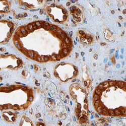 Human TSC2 Antibody, R D Systems 100&mu;g; Unlabeled:Antibodies, Polyclonal