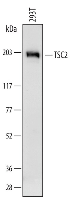 Human TSC2 Antibody, R D Systems 100&mu;g; Unlabeled:Antibodies, Polyclonal