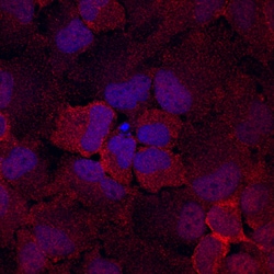 Human/Mouse TSC2 Antibody, R D Systems 100ug; Unlabeled:Antibodies, Monoclonal