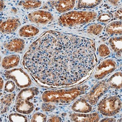 Human/Mouse TSC2 Antibody, R D Systems 100ug; Unlabeled:Antibodies, Monoclonal