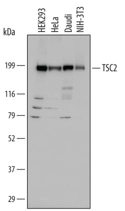 Human/Mouse TSC2 Antibody, R D Systems 100ug; Unlabeled:Antibodies, Monoclonal